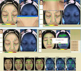 3d Dermatoloji Yüz Cilt Analiz Makinesi Yüz Tarayıcı Cilt Analiz Cihazı 40W